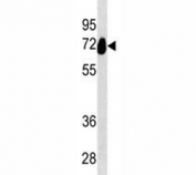 Alkaline Phosphatase antibody western blot analysis in HeLa lysate. Predicted size 60~70 kDa
