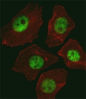 Fluorescent image of A549 cell stained with SOX2 antibody at 1:25. Immunoreactivity is localized to the nucleus.