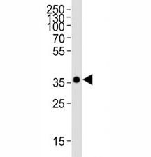 Western blot analysis of SOX2 recombinant protein using SOX2 antibody at 1:4000.