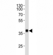 Western blot analysis of lysate from NCCIT cell line using SOX2 antibody at 1:1000.