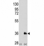 Western blot analysis of SOX2 antibody and 293 cell lysate (2 ug/lane) either nontransfected (Lane 1) or transiently transfected with the SOX2 gene (2).