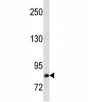 HGF antibody western blot analysis in Ramos lysate. Predicted molecular weight: 76-91 kDa (precursor), 54-64 kDa (alpha chain), 31-34 kDa (beta chain).