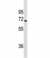 CYP1A2 antibody western blot analysis in SK-BR-3 lysate. Predicted molecular weight ~58 kDa.