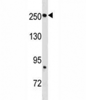 Fatty Acid Synthase antibody western blot analysis in mouse brain tissue lysate. Predicted molecular weight ~ 270 kDa.
