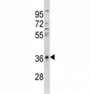 Anti-CTGF antibody western blot analysis in A549 lysate. Predicted/observed molecular weight ~38kDa.