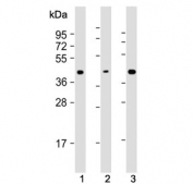 Western blot testing of human 1) Jurkat, 2) CEM and 3) MOLT4 cell lysate with ADA antibody. Expected molecular weight ~41 kDa.