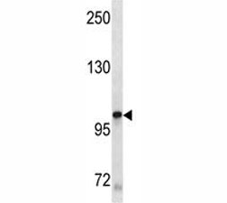 KIT antibody western blot analysis in A549 lysate