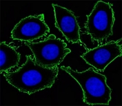 Immunofluorescent analysis of U251 cells using KIT antibody. Ab was diluted at 1:100 dilution. Dylight Fluor 488-conjugated goat anti-mouse lgG was used as the secondary Ab (green). Cytoplasmic actin was counterstained with Dylight Fluor 554 (red) conjugated Phalloidin (red).