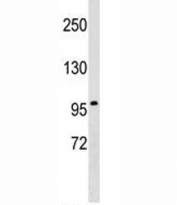 Integrin beta 2 antibody western blot analysis in K562 lysate. Predicted molecular weight 85~95 kDa.