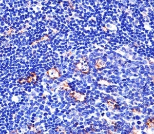 Immunohistochemical analysis of paraffin-embedded human tonsil using Integrin beta 2 antibody at 1:25 dilution.~