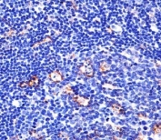 Immunohistochemical analysis of paraffin-embedded human tonsil using Integrin beta 2 antibody at 1:25 dilution.