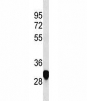 PLP antibody western blot analysis in HeLa lysate. Predicted molecular weight ~30/26 kDa (isoforms 1/2).