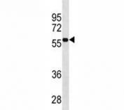 CD33 antibody western blot analysis in HepG2 lysate.  Expected molecular weight: 40-67 kDa depending on glycosylation level.
