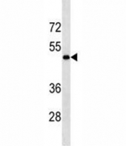 LOX antibody western blot analysis in MDA-MB231 lysate. Expected molecular weight: ~47 kDa (unprocessed/unmodified), ~50 kDa (glycosylated), ~32 kDa (processed form).