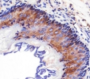 Immunohistochemical analysis of paraffin-embedded mouse esophagus using EGF Receptor antibody at 1:25 dilution.