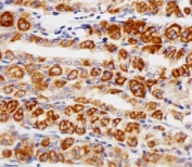 Immunohistochemical analysis of paraffin-embedded human stomach using EGF Receptor antibody at 1:25 dilution.