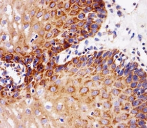 Immunohistochemical analysis of paraffin-embedded human esophagus using EGF Receptor antibody at 1:25 dilution.