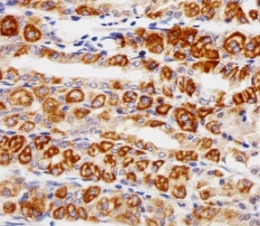 Immunohistochemical analysis of paraffin-embedded human stomach using EGF Receptor antibody at 1:25 dilution.