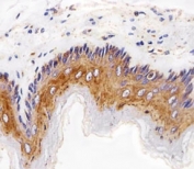 Immunohistochemical analysis of paraffin-embedded rat esophagus using EGF Receptor antibody at 1:25 dilution.