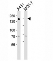 Western blot analysis of lysate from A431, MCF-7 cell line (left to right) using EGF Receptor antibody at 1:1000 for each lane. Expected molecular weight: ~134/170 kDa (unmodified/glycosylated).