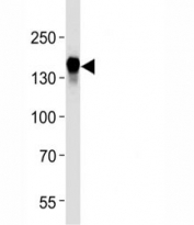 EGF Receptor antibody western blot analysis in HeLa lysate. Expected molecular weight: ~134/170 kDa (unmodified/glycosylated).