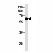 Western blot analysis of recombinant protein using KLF4 antibody at 1:1000. Predicted molecular weight: 50-60 kDa + possible ~75 kDa (phosphorylated form).