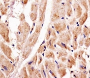 Immunohistochemical analysis of paraffin-embedded human heart using Pink1 antibody at 1:25 dilution.