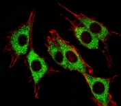 Fluorescent image of PC12 cells stained with Pink1 antibody. Ab was diluted at 1:25 dilution. An Alexa Fluor 488 secondary was used (green). Cytoplasmic actin was counterstained with Alexa Fluor 555 conjugated with Phalloidin (red).