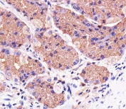 Immunohistochemical analysis of paraffin-embedded human stomach using Pink1 antibody at 1:25 dilution.