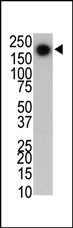 The PARK8 antibody used in western blot to detect LRRK2/PARK8 in mouse brain cell lysate
