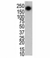 The LRRK2 antibody used in western blot to detect LRRK2/PARK8 in mouse brain cell lysate.