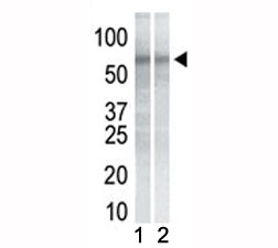 Western blot testing of mouse NIH3T3 cell lysate (Lane 1) and human K562 cell lysate (2) with CHK1 antibody.