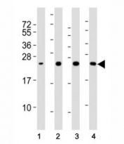 Western blot testing of SOD2 antibody at 1:2000 dilution and human samples. Lane 1: HeLa lysate; 2: brain; 3: heart; 4: liver lysate; Predicted molecular weight ~ 25 kDa.
