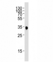 Western blot analysis partial EPHB2 protein using EphB2 antibody at 1:1000.