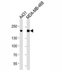 Western blot analysis of lysate from A431, MDA-MB-468 cell line (left to right) using EGFR antibody at 1:1000 for each lane.
