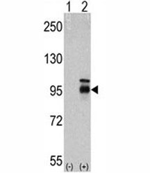 Western blot analysis of FGFR4 antibody and 293 cell lysate either nontransfected (Lane 1) or transiently transfected with the FGFR4 gene (2). ~