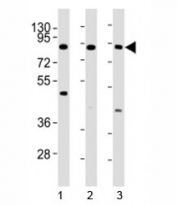Western blot testing of IKKb antibody at 1:4000 dilution. Lane 1: HL-60 lysate; 2: HeLa lysate; 3: Jurkat lysate; Predicted molecular weight ~87 kDa.