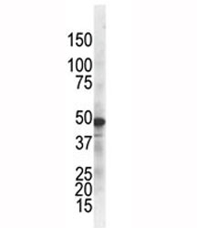 The IKK gamma antibody used in western blot to detect IKKg in ZR75-1 cell lysate. Predicted molecular weight ~48 kDa.