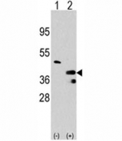 Western blot analysis of PRMT1 antibody and 293 cell lysate either nontransfected (Lane 1) or transiently transfected with the PRMT1 gene (2).