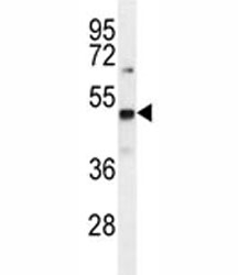 PRMT1 antibody western blot analysis in mouse Neuro-2a lysate~