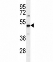 PRMT1 antibody western blot analysis in mouse Neuro-2a lysate