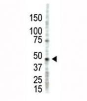 The PRMT2 antibody used in western blot to detect PRMT2 in HL-60 cell lysate