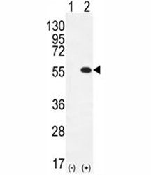 Western blot analysis of PRMT2 antibody and 293 cell lysate either nontransfected (Lane 1) or transiently transfected (2) with the PRMT2 gene.~
