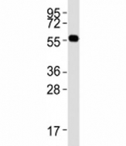 Western blot testing of PRMT3 antibody at 1:2000 dilution + mouse brain lysate; Predicted molecular weight: 55-60 kDa.