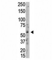 Western blot analysis of PRMT3 antibody and whole HL-60 cell lysate. Predicted molecular weight: 55-60 kDa.
