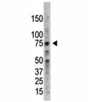PRMT5 antibody used in western blot to detect PRMT5 in HL-60 cell lysate. Expected molecular weight ~72kDa.