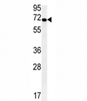 KEAP1 antibody western blot analysis in HepG2 lysate. Predicted molecular weight ~70 kDa.