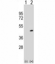 Western blot analysis of PRMT6 antibody and 293 cell lysate either nontransfected (Lane 1) or transiently transfected (2) with the PRMT6 gene.