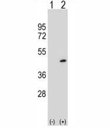 Western blot analysis of PRMT6 antibody and 293 cell lysate either nontransfected (Lane 1) or transiently transfected (2) with the PRMT6 gene.