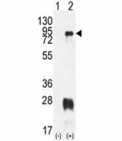 Western blot analysis of PRMT7 antibody and 293 cell lysate either nontransfected (Lane 1) or transiently transfected with the PRMT7 gene (2).